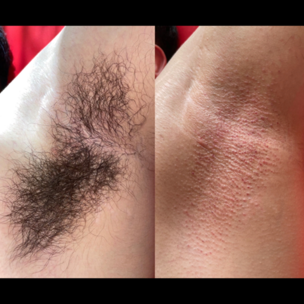 Underarm Wax at De Colores Beauty Bar in Chicago, IL