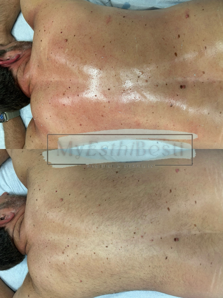 Back Wax