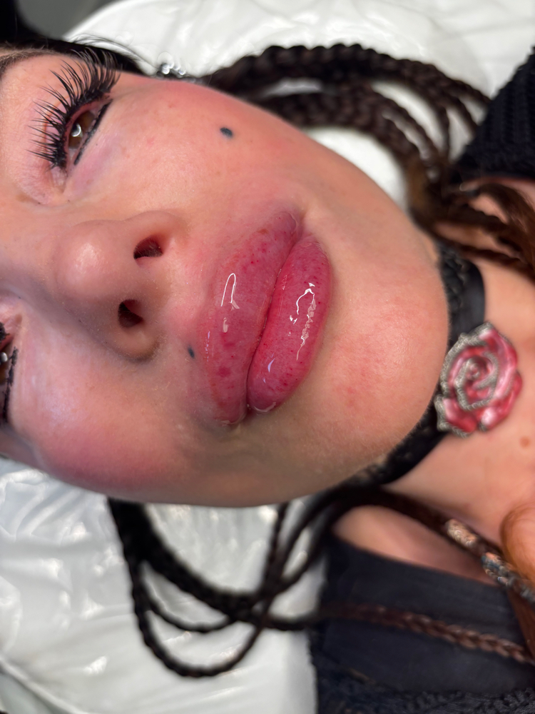 1 ML Natural Plump