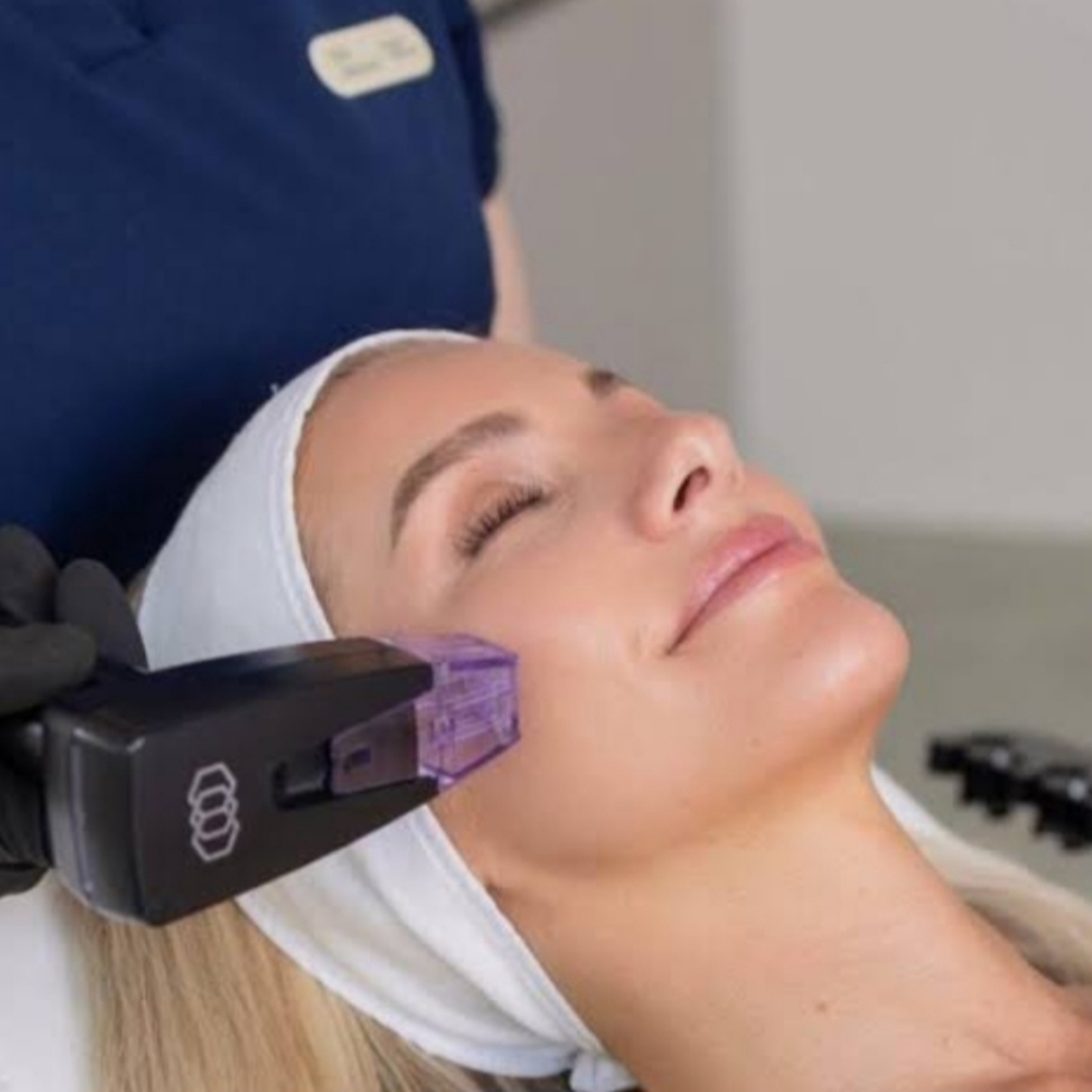 Morpheus 8 at Lavana Medspa in Edinburg, TX