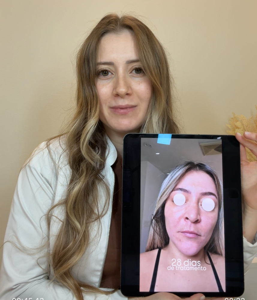 Consulta Tratamento De Melasma at Jessica Luchesi Skin Wellness in Elizabeth, NJ