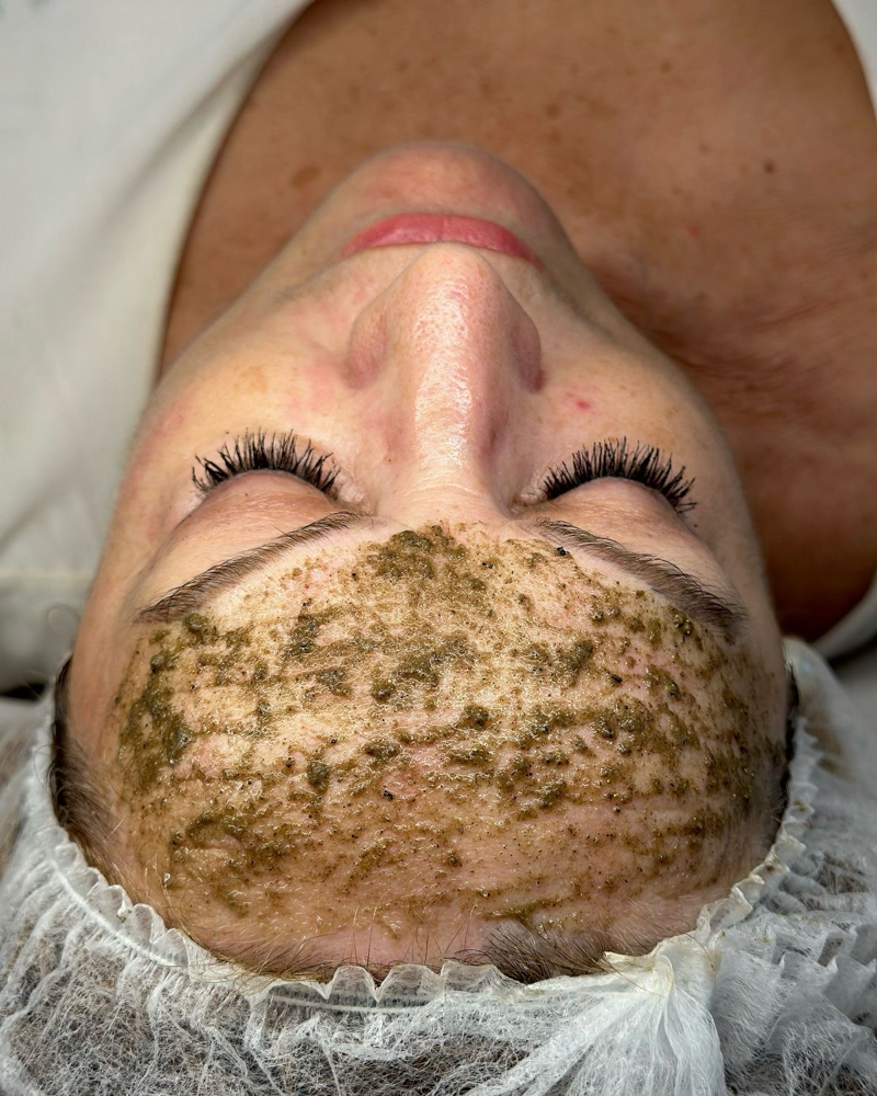 Peeling Rose De Mer 1 Session “sale
