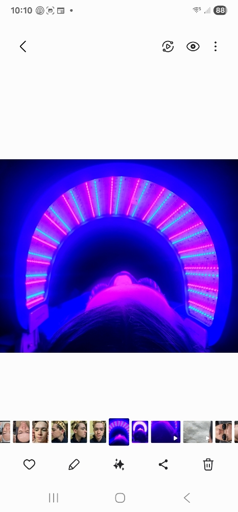 Add On LED light to existing treatm