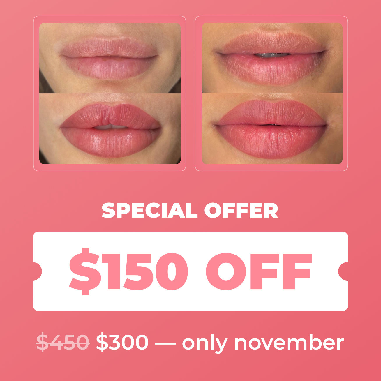 Lips 💋 $300 November Special