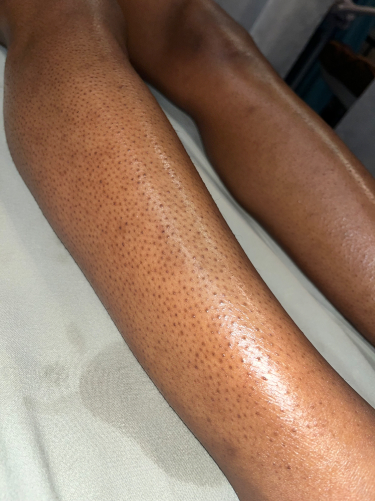 Leg wax