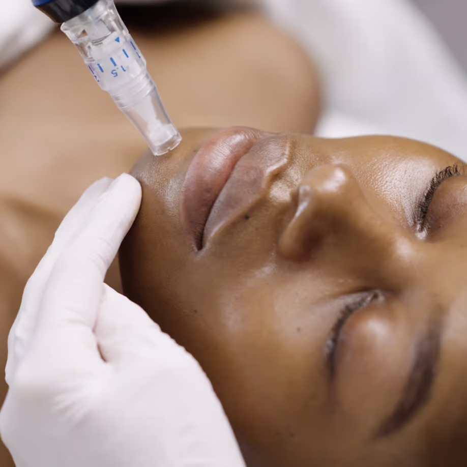 Collagen Induction Therapy Course