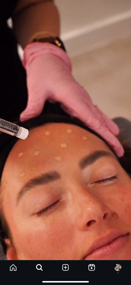 Rejuran (Salmon DNA) Skin Rejuvenat