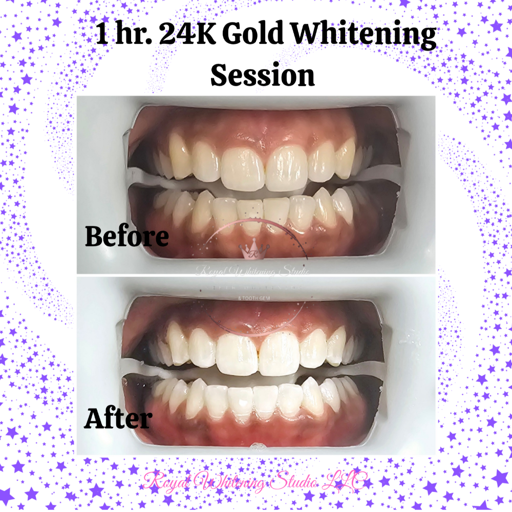 1 Hr. 24k Gold Whitening