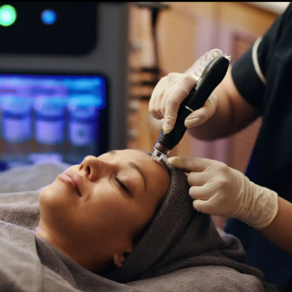 Nano-Needling Signat Skin Treatment