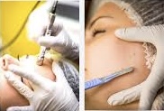 Standalone Dermaplane or Microderm