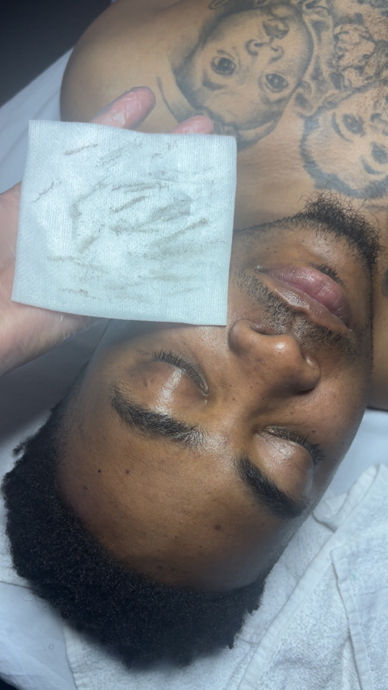 Skin Renewing Facial at Runway Esthetics in Racine, WI