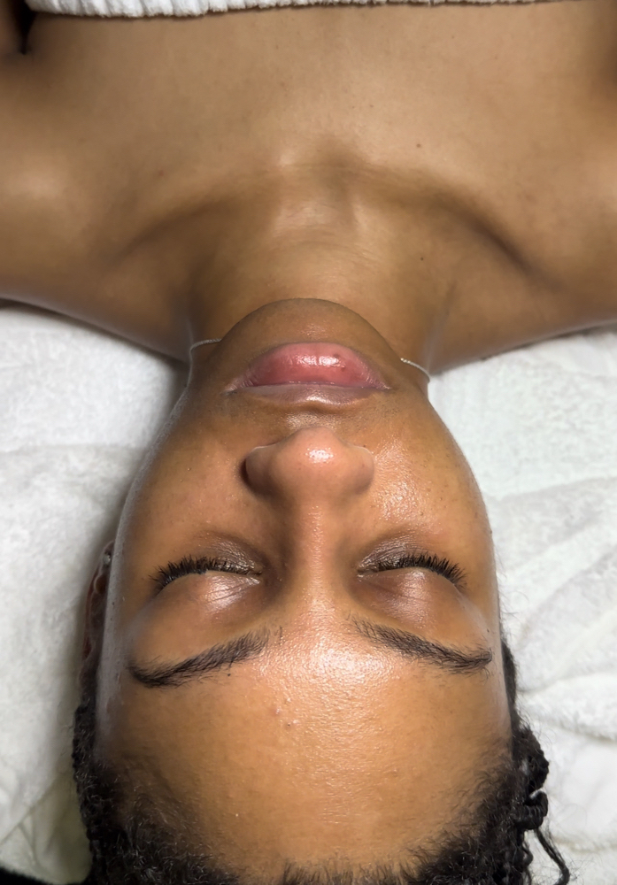 TruTeen Facial