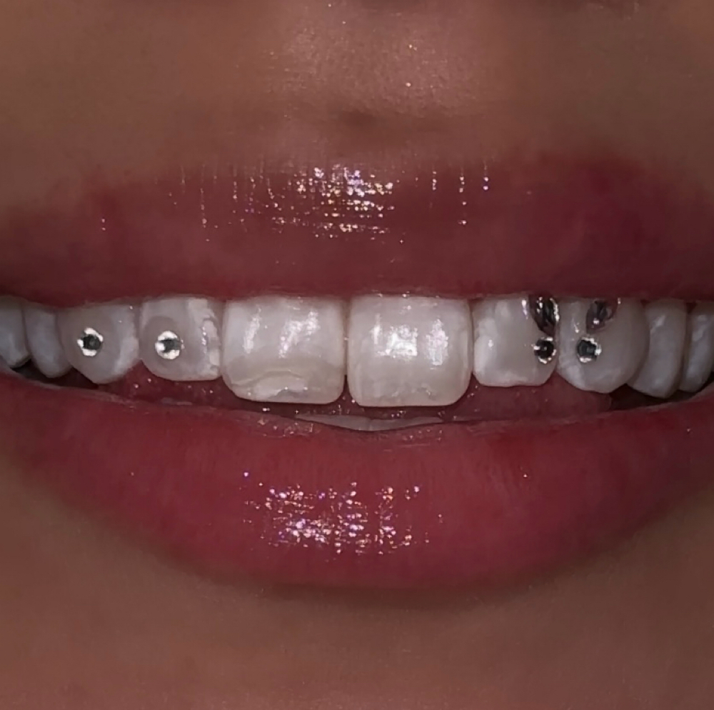 Butterfly Set + 2 Gems at Beauty by MSG in Des Plaines, IL