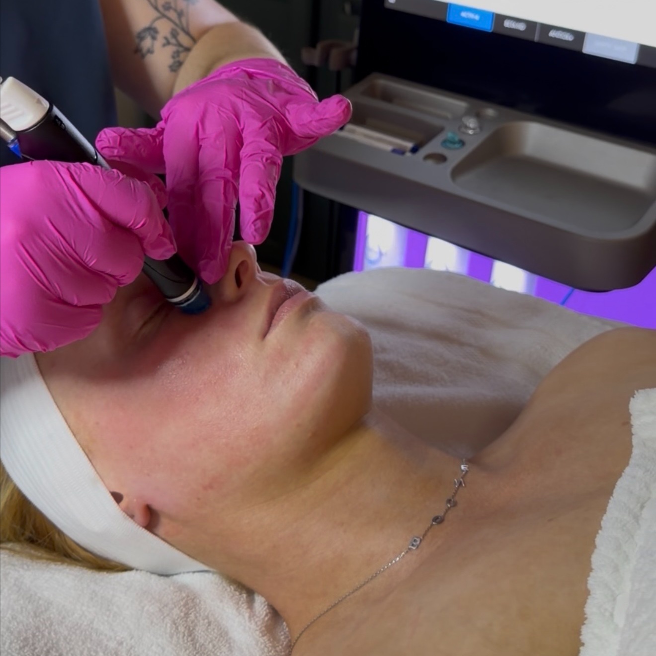 Deluxe Hydrafacial at Luxe Lineage Esthetics in Christiansburg, VA