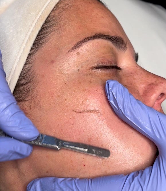 Dermaplaning Facial