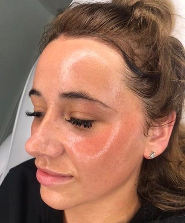 Glow Facial ✨