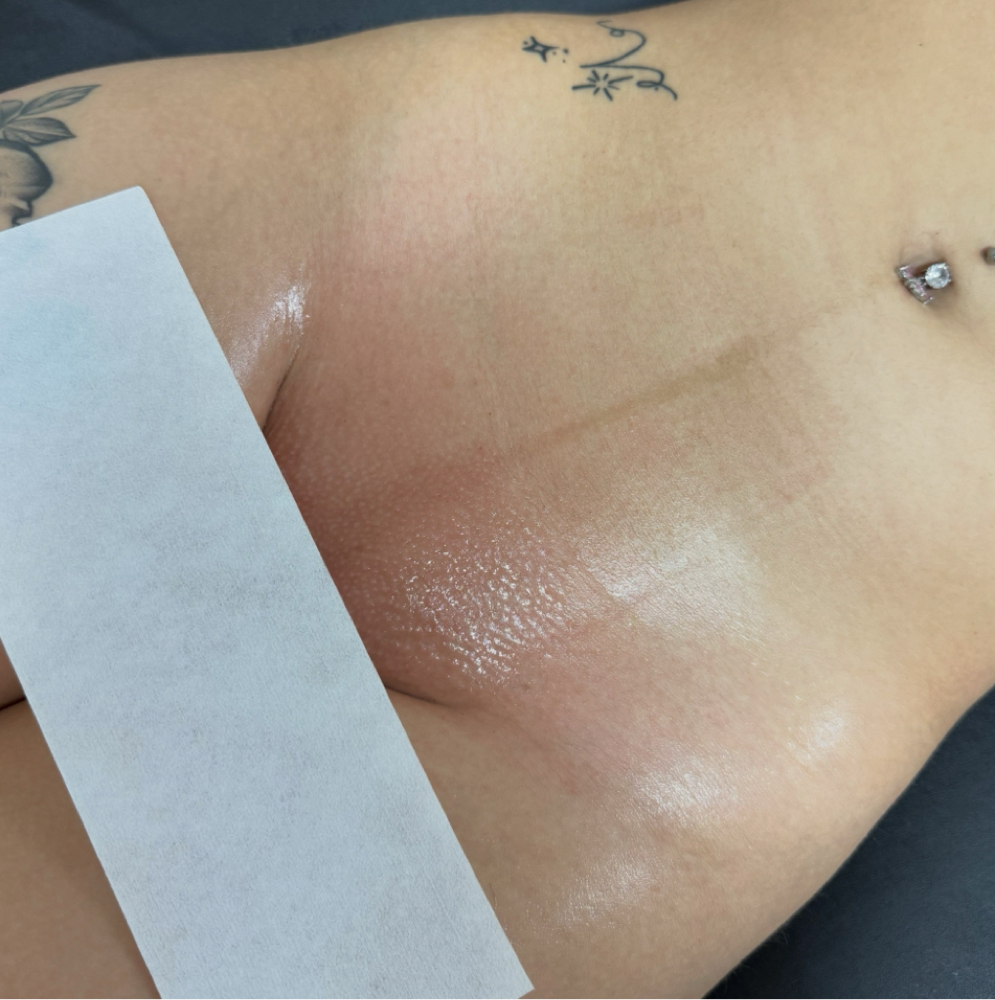 Brazilian at Pretty Gals Esthetics in San Antonio, TX