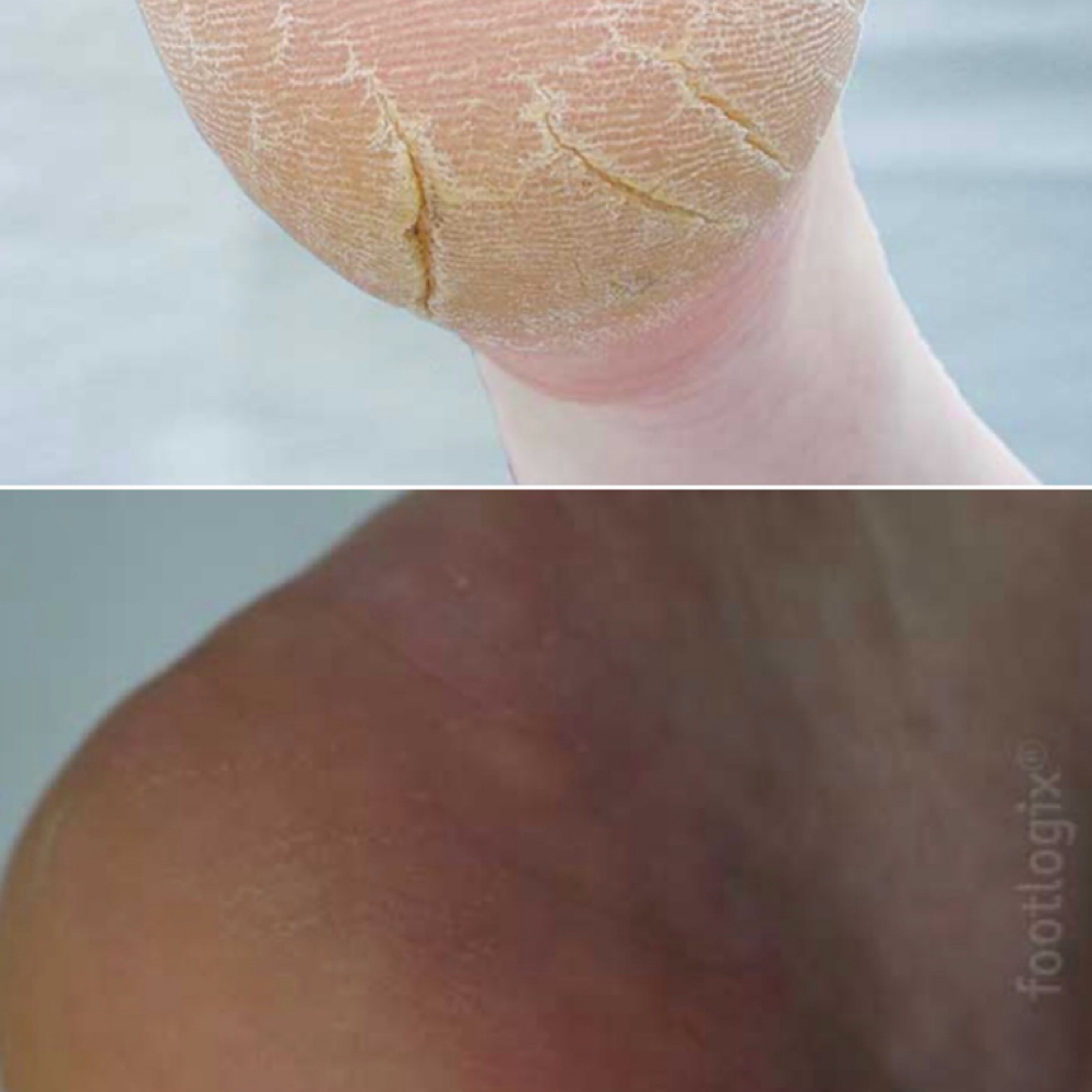 Medical-Grade Pedicure at Viziatta Nails in Philadelphia, PA