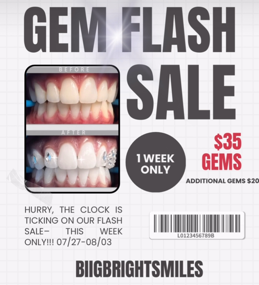 Gem Flash SALE