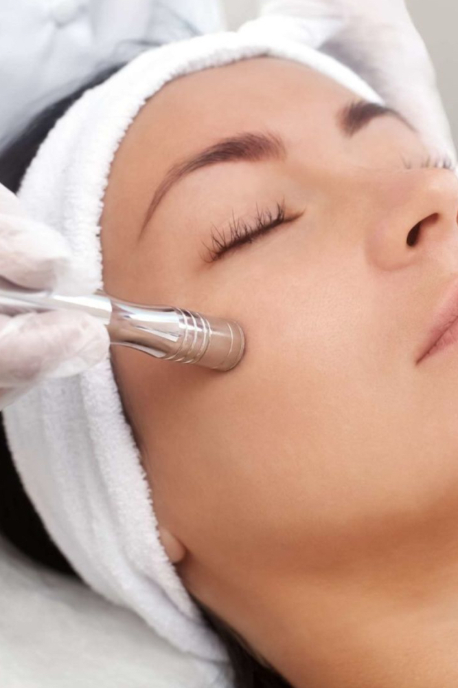 Microdermabrasion Facial