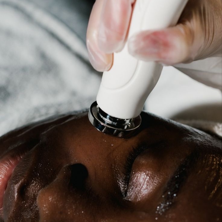 Radiofrequency skin tightening at THE MED BAR in Colorado, CO