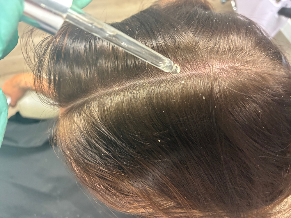 Signature Scalp Treatment