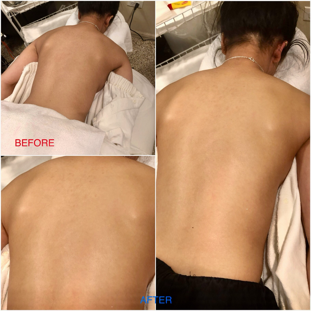 Back Facial