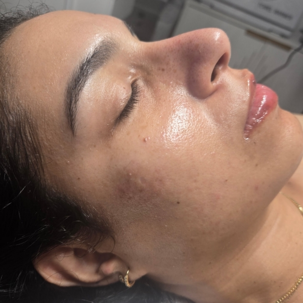 A1 Advanced Skin Therapy Facial at Stephs A1 Beauty Bar in Southwest Ranches, FL