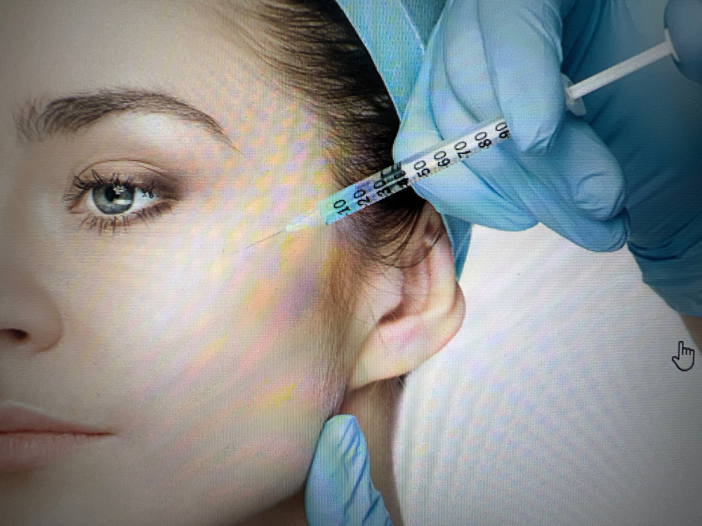 Dermal Filler