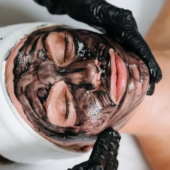 Acne Oxygen Facial at Elevate Aesthetics in Sandy, UT