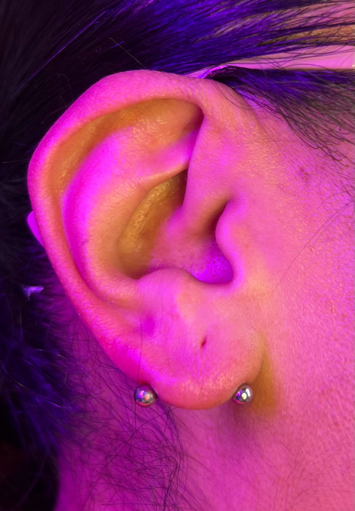 Transverse Lobe