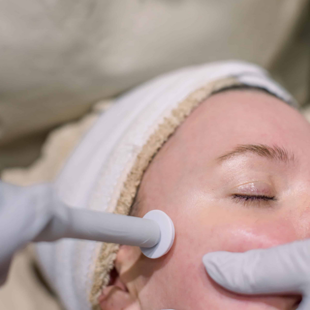 Procell Microchanneling & Aftercare at ALL HEART BEAUTY: Esthetics & Wellness in Advance, NC