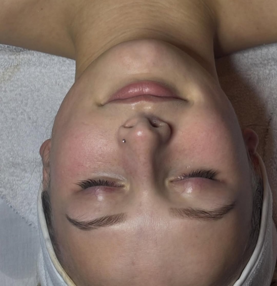 Hydrating facial