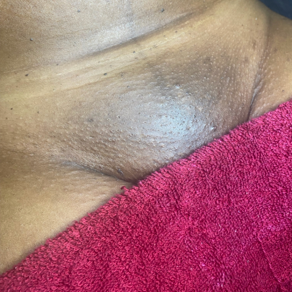 Vajacial & Wax at WYN SKIN & BROWS in Dallas, TX