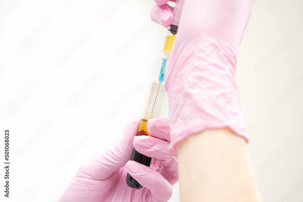 PRP BLOOD DRAW