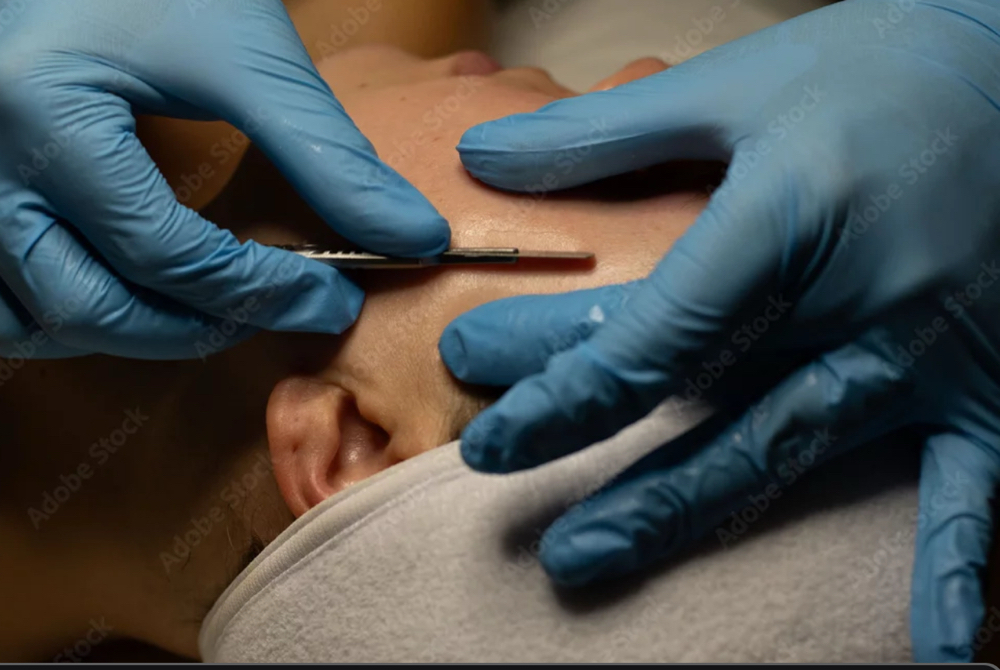 Dermaplane Glow Facial