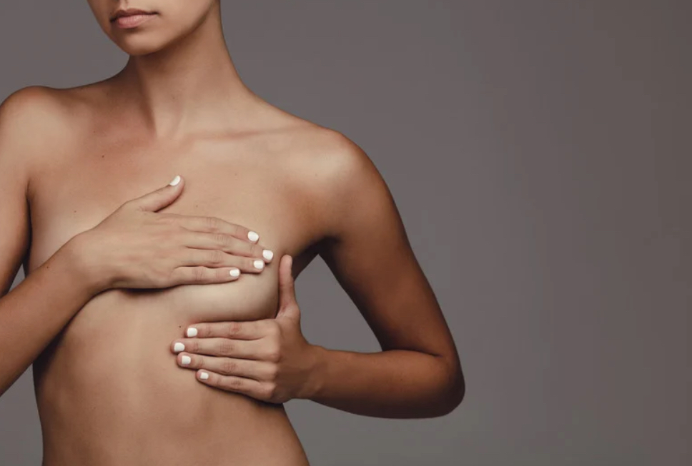 Breast Stretchmark Camouflage