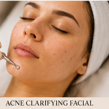 Acne Clarifying Facial at Glow on the Go by Yesenia in Peekskill, NY