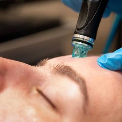 Deluxe Hydro Facial