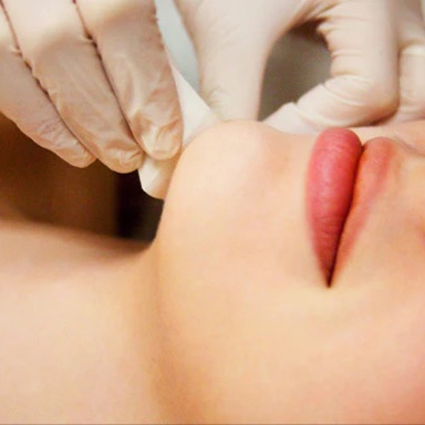 Chin Wax at Simply Aesthetics in Round Rock, TX