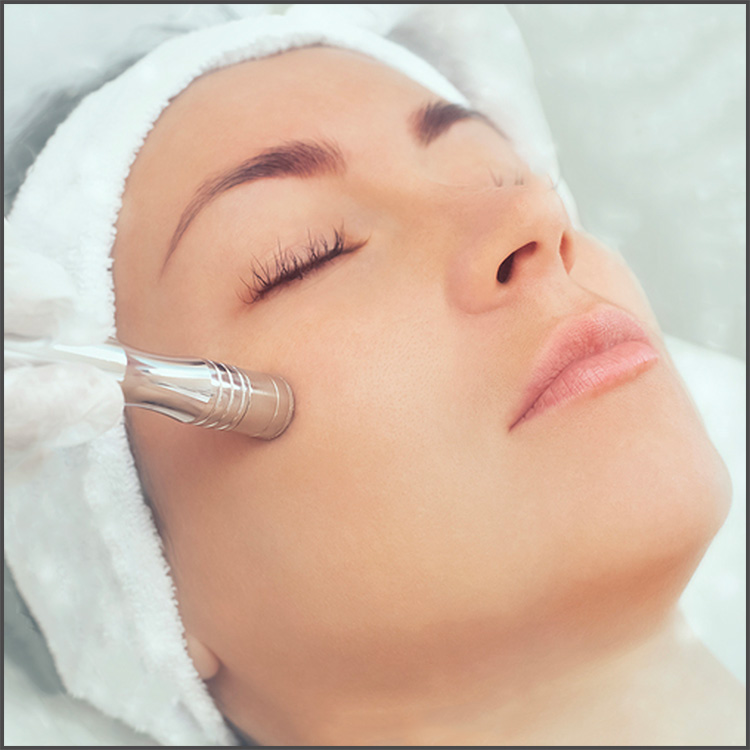 Microdermabrasion Facial