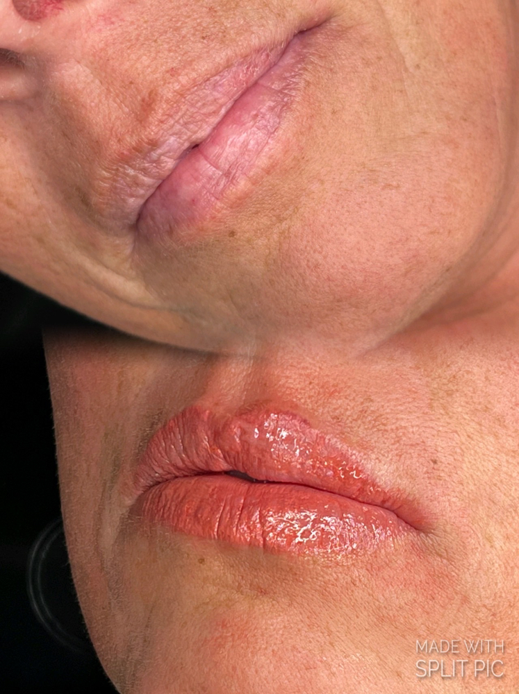 Lip Blushing