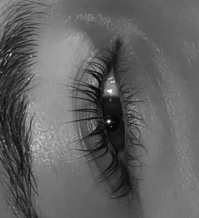 Lash Lift