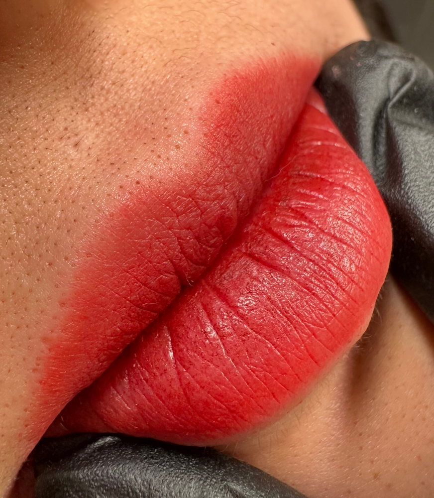 Lips Touch-up (After 4 - 8 Months)
