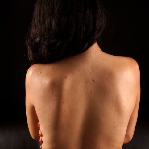 Purifying Back Facial Treatment at Milan Salon Spa in El Paso, TX