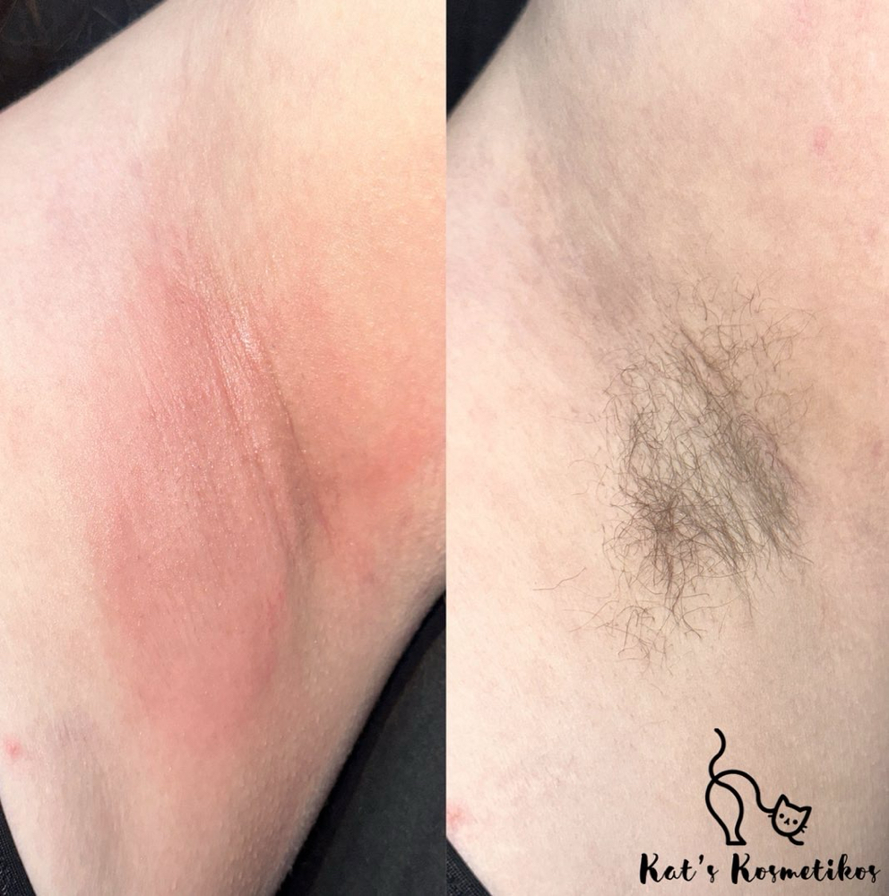 Underarm Wax
