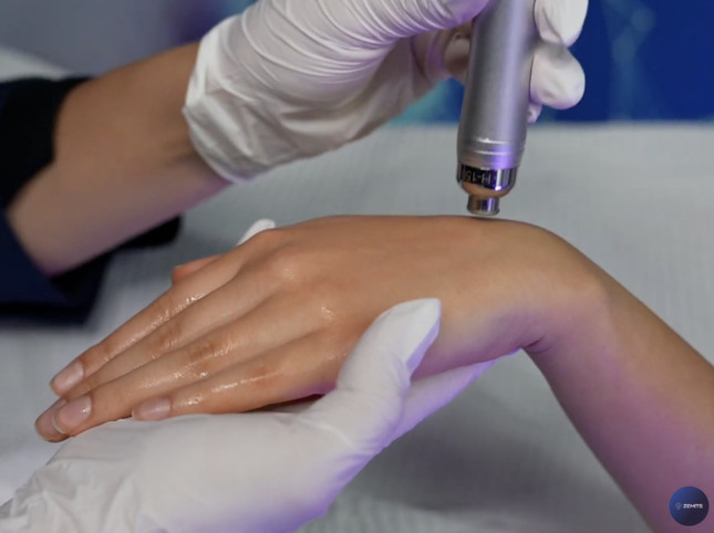 Add-On Hydro Diamond Hand Treatment