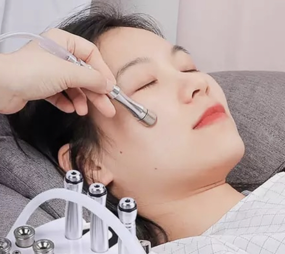 Newday Microdermabrasion Facial