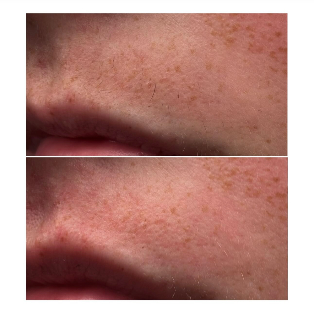 Upperlip Wax at Sweet Touch Esthetics in Farmingdale, ME