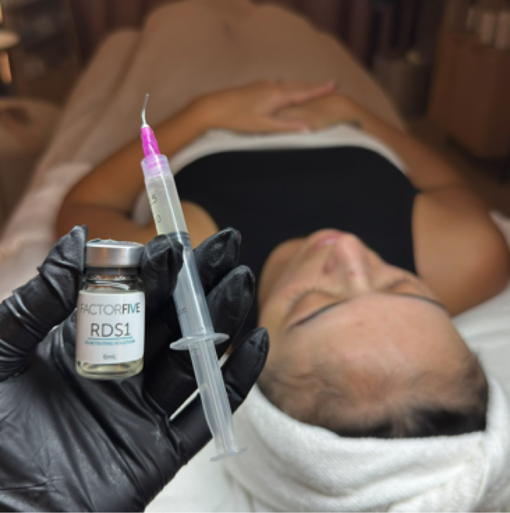 FactorFive RDS Tx at Glowing Skin Esthetics in Claremont, CA